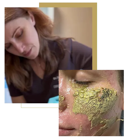 Dottoressa Simona Blidar che esegue un trattamento viso con peeling al fenolo, applicazione della soluzione sul volto della paziente